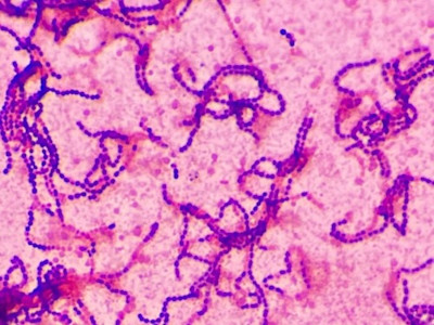 Figure 2. Gram-positive cocci in chains. Strep A children. December 2023