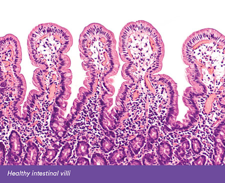 healthy villi - coeliac - October 2019.