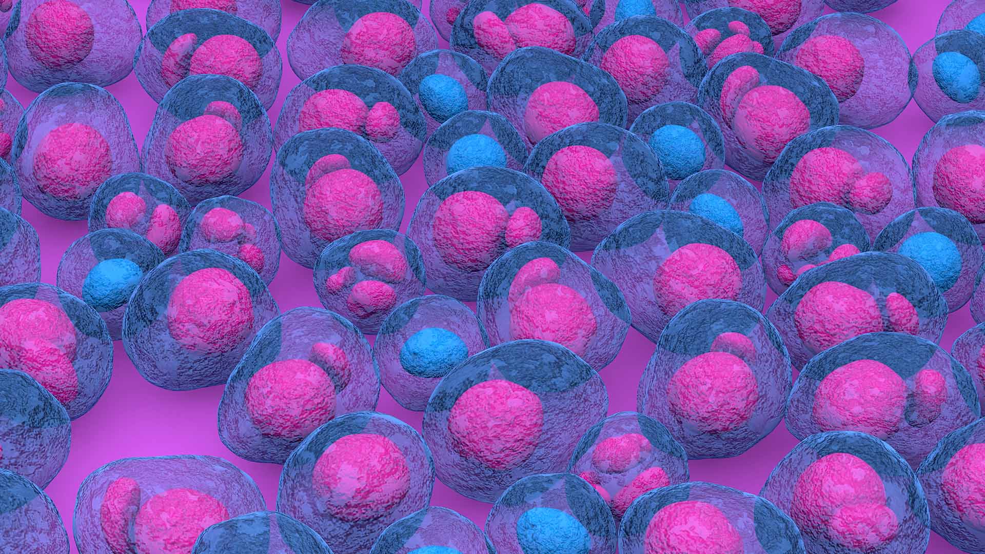 Sept 2024 - Multiple Myeloma