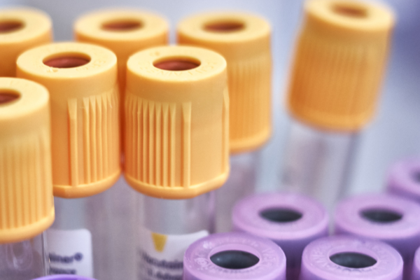 Biochemical Blood Tests
